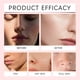 thumbnail image 3 of Pisexur Belleza Maquillaje Crema facial hidratante y humectante 30 g Reduce la pigmentación Manchas oscuras y opacidad Mejora el tono Ilumina y calma Repara Larga duraciónpara mujeres y hombres, 3 of 4
