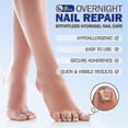thumbnail image 3 of Toenail Fungus Patch Antiseptic Nail Repair Patches Nail Ingrown Correction Stickers for Discolored Or Damaged Nails, 3 of 5