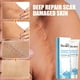 thumbnail image 2 of Crema de eliminación de ácido azelaico 20%, Gel facial para eliminar manchas de acné, Control de aceite, antiacné, encoge los poros, tratamiento para el acné, cicatriz de la piel, 15g"15g" Fivean LED, 2 of 2