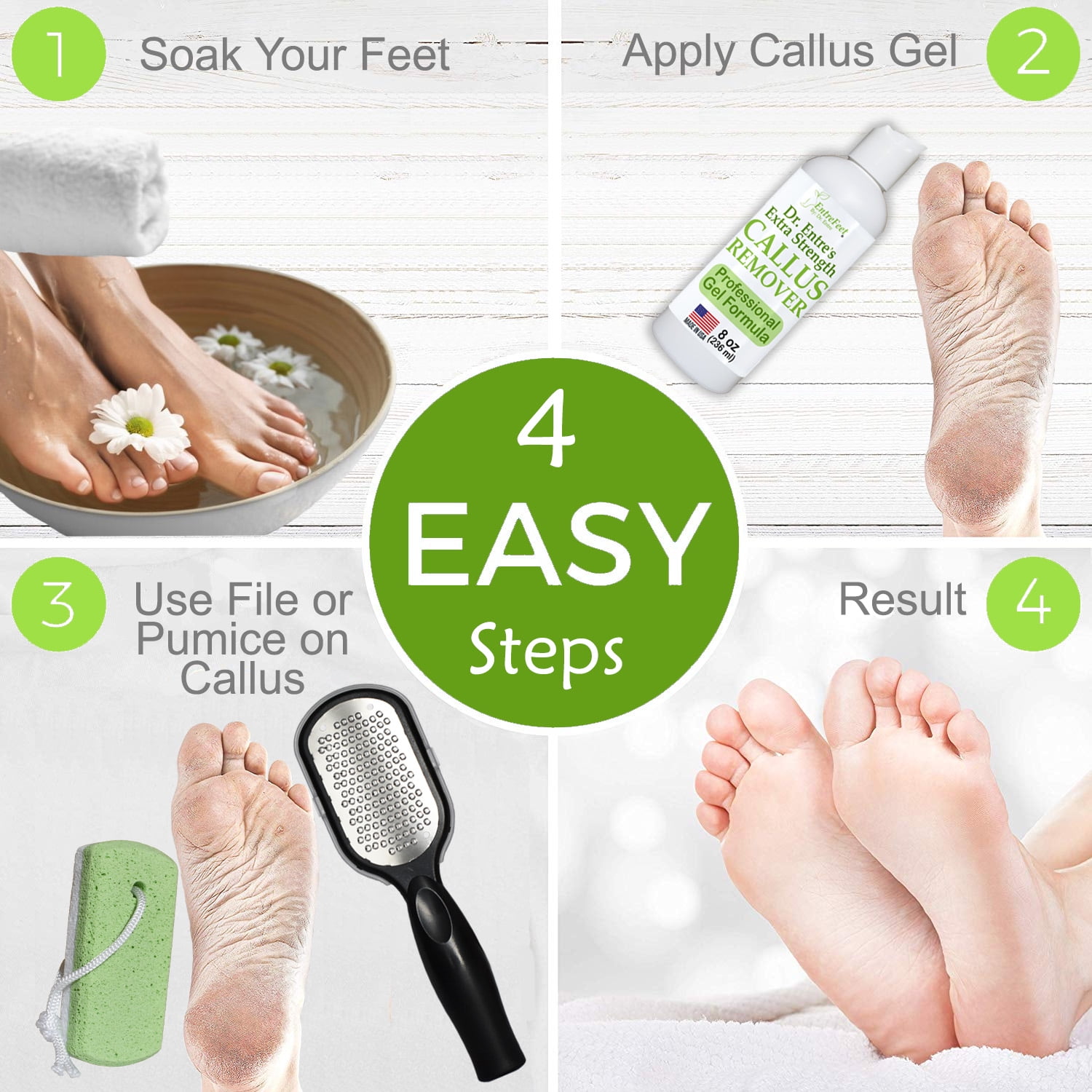 Best pumice stone for dry heels sale