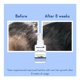 thumbnail image 2 of Sérum Capilar Fortalecedor y de Crecimiento – Con Extracto de Romero, 3% Redensyl, 4% Anagain, 2% Baicapil, Cafeína, Biotina y Agua de Arroz – Tratamiento para el Cabello, 2 of 6
