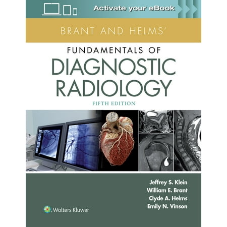 UPC: 9781496367389 | Brant and Helms  Fundamentals of Diagnostic Radiology (Hardcover)