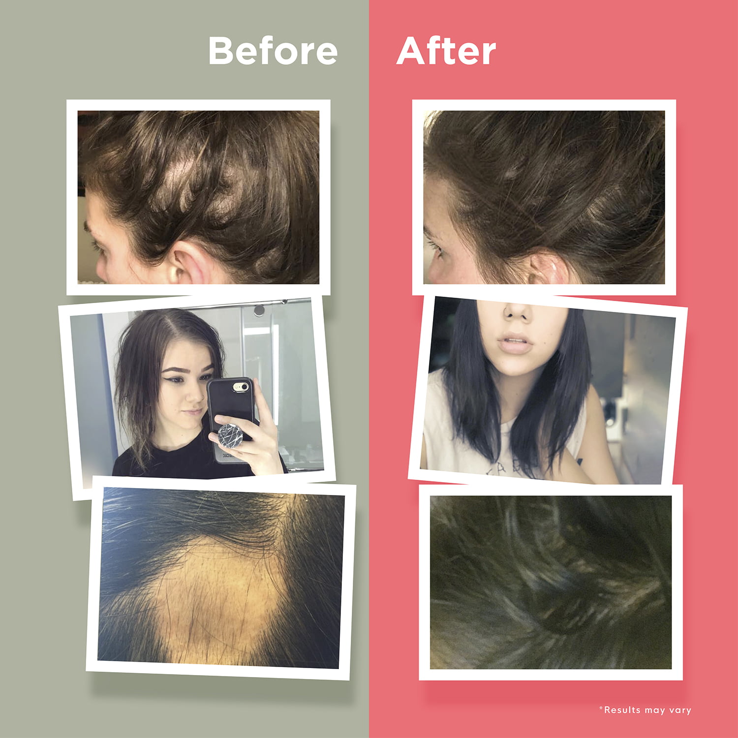 Hair Loss Singapore - Doctor's Guide to Hair Growth+ inClinic by Nourkin®