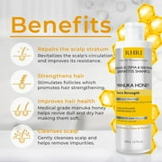 Psoriasis Shampoo with Manuka Honey | Best Itchy Scalp Treatment for Eczema