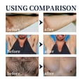 thumbnail image 4 of LILELIS Hair Removal Spray Foam For Men No Irritation Hair Removal Hair Depilatory For Male Underarm Chest Back Legs Hot compatible with Machine for Hair Removal before And after Waxing Spray, 4 of 9