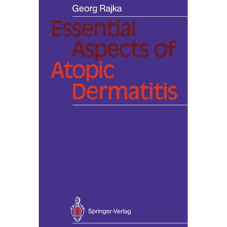 Essential Aspects of Atopic Dermatitis - eBook