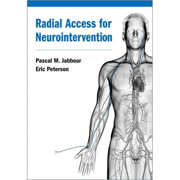 Radial Access for Neurointervention, (Hardcover)