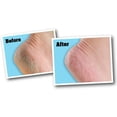 thumbnail image 2 of O'Keeffe's for Healthy Feet 2.7 oz, 2 of 2