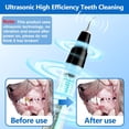 thumbnail image 3 of Limpiador ultrasónico para mascotas Ni-shen, removedor de placa dental, negro, 3 of 7
