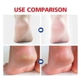 thumbnail image 4 of Foot Moisturizing Cream, 20g Feet Cream Fast Relief Nasty Odor Removal  For Daily Care, 4 of 8