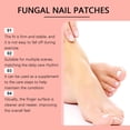 thumbnail image 6 of Toenail Repair Patch Set for Ingrown and Damaged Nails 63 Pieces Adhesive Protective Strips for Nail Care and Maintenance Suitable for Daily Use and Various Nail Shapes, 6 of 7