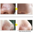 thumbnail image 5 of Pore Strips, Blackhead Remover Strip, Nose Strips Blackhead Remover, Nose Strips, Black Nose Mask Cleaning Nasal Patch, Deep Cleansing Pore Strips, 5 of 5