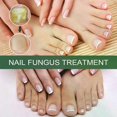 thumbnail image 2 of Extra Strong Nail Fungus Treatment, Best Nail Repair Stop Fungal Growth Effectiv, 2 of 5