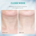 thumbnail image 5 of OZUAZ Red Light Therapy for Face, LED Face Skin Rejuvenation for Face & Neck Beauty Device  Anti Wrinkle Skin Care Tools, 5 of 6