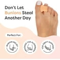 thumbnail image 2 of ZenToes Pack of 4 Toe Separators and Spreaders For Bunion, Overlapping Toes and Drift Pain - Beige, 2 of 8