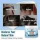 thumbnail image 2 of 2025 Seborrheic Dermatitis Cream, Anti Fungal Shampoo, Scalp Treatment for Psoriasis, Folliculitis, Dry Scalp, Anti-Itch, Sooth_c*, 2 of 5