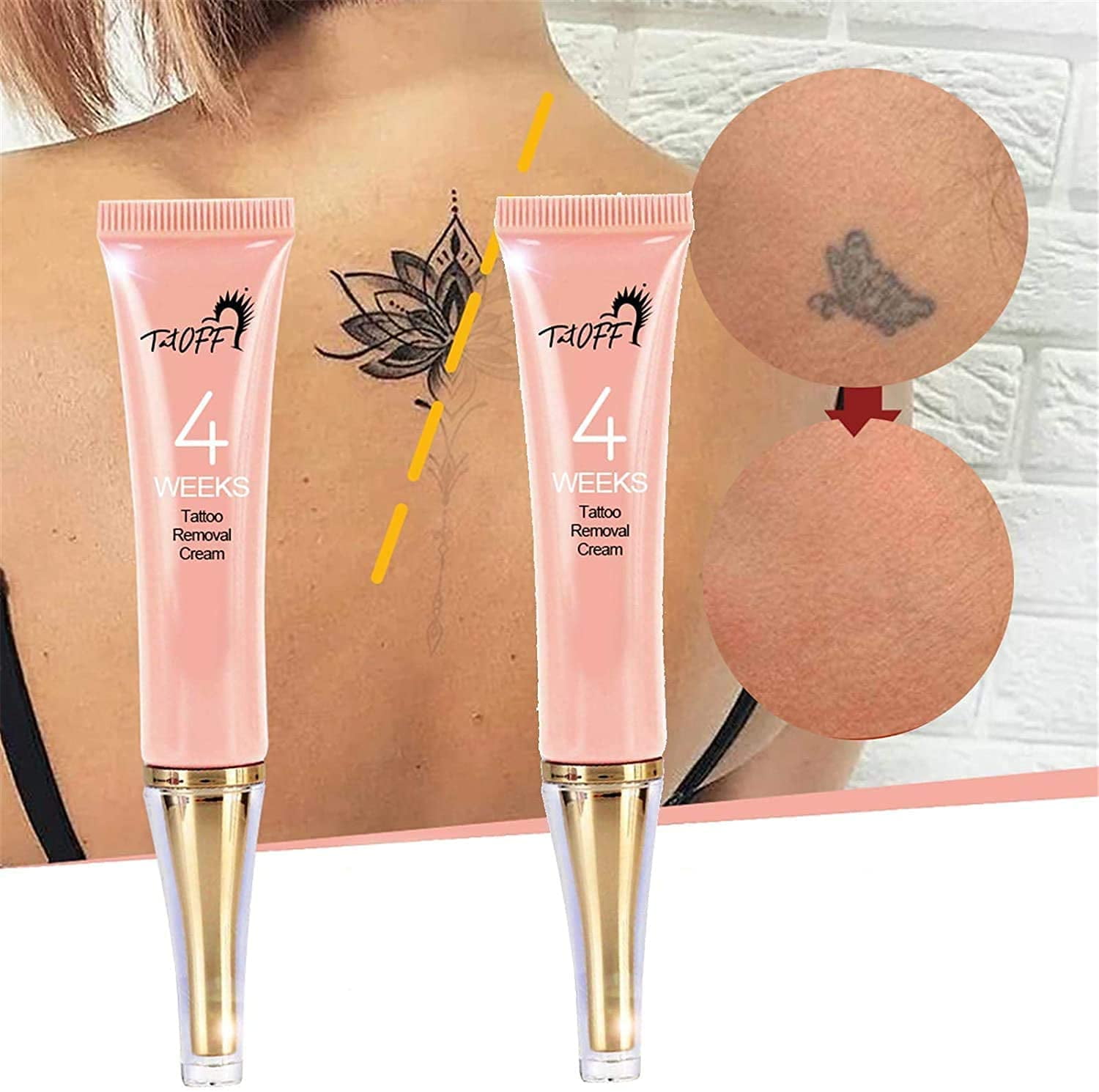 4 weeks tattoo removal cream,Tattoo remover,Permanent tattoo removal,tattoo  removalSafe moisturizing skin with black tattoos (2PC) 