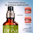 thumbnail image 3 of Amáre Gel dermolimpiador para piel con brotes e irritación recurrente, 3 of 5