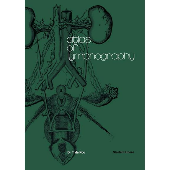 Atlas of Lymphography, (Paperback)