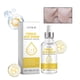 thumbnail image 2 of Vitamina Vitamina C Antiarrugas Hidratante Rejuvenecimiento Facial Reafirmante Reparación 30ml Esencia agua, 2 of 5