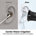 thumbnail image 2 of Limpiador de oídos recargable e irrigador de oídos para uso doméstico | Herramienta segura para eliminar el cerumen | Lavador de oídos portátil para el baño del hogar, 2 of 9