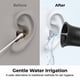 thumbnail image 2 of Limpiador de oídos recargable e irrigador de oídos para uso doméstico | Herramienta segura para eliminar el cerumen | Lavador de oídos portátil para el baño del hogar, 2 of 9