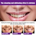 2 Pack Colour Corrector, Tooth Stain Removal, Teeth Whitening Booster