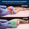 thumbnail image 3 of Knee Pillows, Memory Cotton Knee Pillows, Leg Positioning Pillows, Sciatica Relieve, Are Great For Side Sleepers, 3 of 5