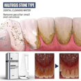 thumbnail image 2 of Jaysuing Tartar Dissolving Mouth Spray Tartar Removes Bad Breath And Tartar, 2 of 5
