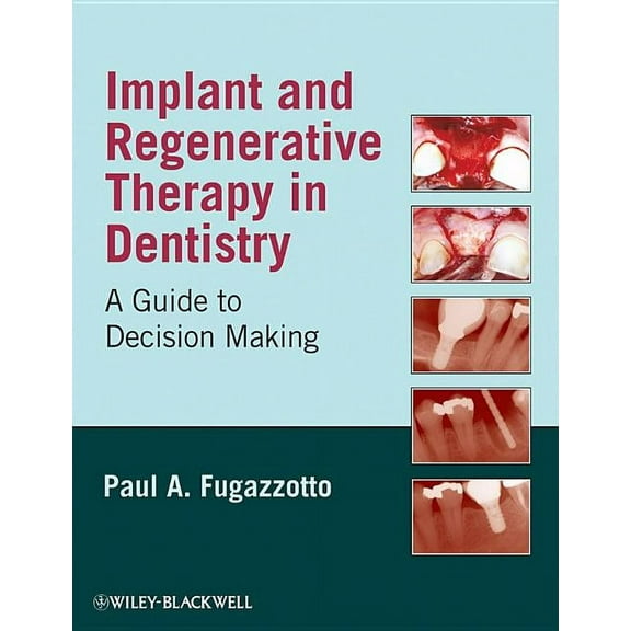 Implant and Regenerative Thera, (Hardcover)