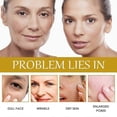 thumbnail image 4 of Jaysuing Bee Venom Essence Repair Dark Moisturizing Fading Wrinkle French Lines Firming Skin Anti-Wrinkle Essence -, 4 of 5