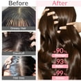 thumbnail image 3 of Onion Shampoo and Conditioner Set, with Rosemary and Biotin, Formula for Thinning Hair Care, Thickening Products for Women and Men, 3 of 9