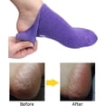 thumbnail image 5 of Comfort Gel Socks for Men and Women - Soft Spa Silicone Gel Infused Moisturizing Socks (Purple (1 Pair)), 5 of 5