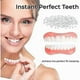 thumbnail image 2 of Advanced Customized Full Denture Set, Silicone Reline Denture Set, 2 of 4