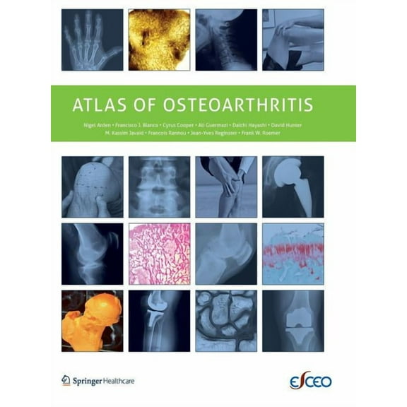 Atlas of Osteoarthritis, (Paperback)