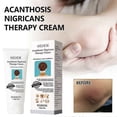 thumbnail image 4 of 1/2/3pcs Acanthosis Cream Nigrifix Cream For Acanthosis Nigricans Black Spot, 4 of 5