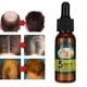 thumbnail image 4 of Suero Para El Cabello, 30 Ml De Cabello Brillante Fortalece Las Raíces Del Cabello Repara El Folículo Piloso Aceite Para El Crecimiento Del Cabello Para Permanente Cabello Rizado, 4 of 7