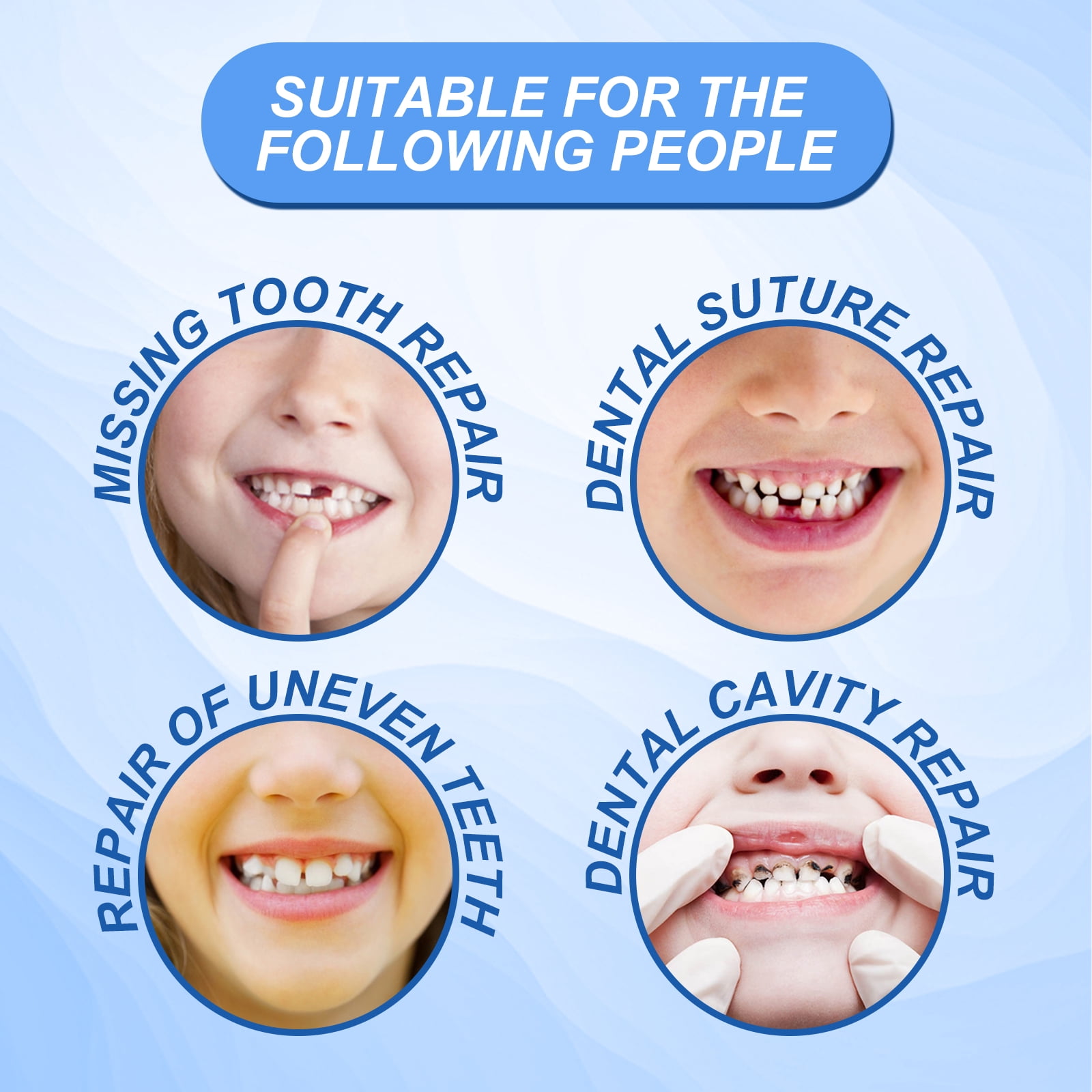 Alvantor Temporary Tooth Replacement Kit