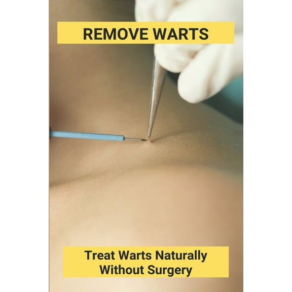 Remove Warts: Treat Warts Naturally Without Surgery: Boost Immune System To Get Rid Of Warts, (Paperback)