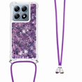 thumbnail image 1 of Funda FOXDOCK para Xiaomi 14T con Cuerda Ajustable, Brillo Líquido, Protección Antigolpes y Lente – Ideal para Regalo, 1 of 6