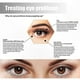 thumbnail image 2 of Anti-Aging Eye Serum for Dark Circles, Puffiness, Wrinkles, and Fine Lines Reduction Treatment Solution, 2 of 5