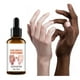 thumbnail image 5 of Sérum aclarador de articulaciones, codos, axilas y rodillas, antimelanina, 30 ml. Esencia., 5 of 5