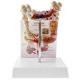 thumbnail image 4 of 1: 2 Modelo ógico de Grueso Herramienta de ñanza de Escuela Sunnimix Estatua de disco de intestino grueso, 4 of 8