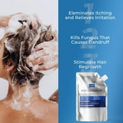 Anti Dandruff Shampoo Anti Fungal Dandruff Mens Shampoo | Medicated, Clarifying, Psoriasis & Biotin Shampoo