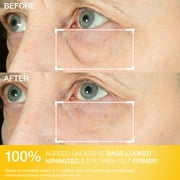 StriVectin Hyperlift Eye™ Instant Eye Fix, 0.34 fl oz