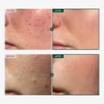 thumbnail image 2 of Sérum facial TOSOWOONG Madagascar Centella 86% Ampolla 100 ml, 2 of 6