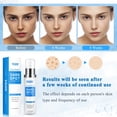 thumbnail image 4 of Eliminador de manchas oscuras VBBV para rostro y cuerpo, 50 ml para mujeres y hombres, 4 of 8