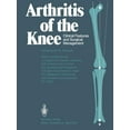 thumbnail image 1 of Arthrite du Genou, 1 of 2