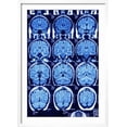 thumbnail image 2 of Brain Scans, MRI Scans, Figurative Framed Art Print Wall Art by PASIEKA Sold by Art.Com, 2 of 6