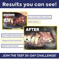 thumbnail image 4 of Polvo dental TEEF FOR LIFE Protektin42 para perros, 30 porciones, 4 of 7